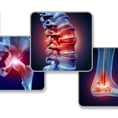 Pain Of The Joints